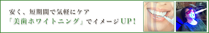 安く、短期間で気軽にケア「美歯ホワイトニング」でイメージUP！